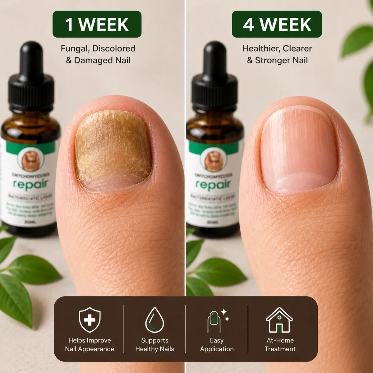 Anti Fungal Nail Repair Serum ( Pack Of 2 )