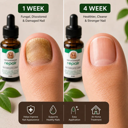 Anti Fungal Nail Repair Serum ( Pack Of 2 )